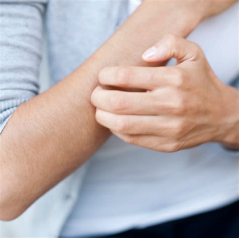 What Causes Itching? - Scientific Reasons Behind Why We Itch