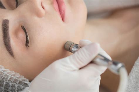 Microdermabrasion Results: What to Expect - AesthetHouse.com