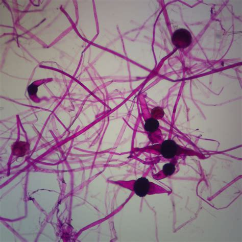 Rhizopus (Zygomycetes) Microscope Slides | Carolina.com