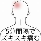 後頭部が5分間隔で痛む  品川駅�辺 はりきゅう専門の鍼灸院｜はりきゅうルーム カポス sketch template
