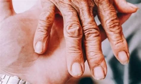 Joint injections, creams ineffective for treating hand arthritis: Study