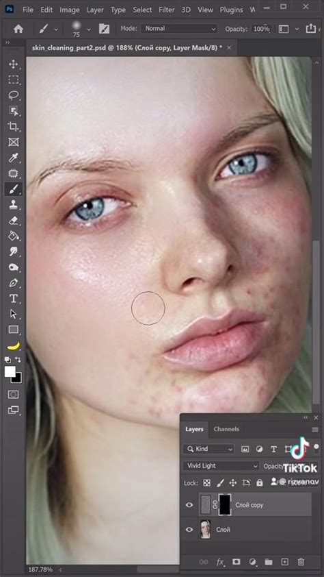 Remove pimples / acne in Photoshop [Video] in 2021 | Photo manipulation, Photoshop, Photoshop ...