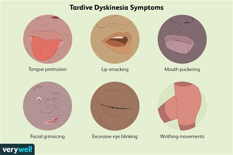 Early Signs of Tardive Dyskinesia