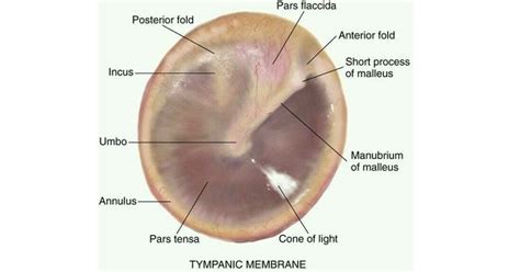 Malleus Tympanic Membrane