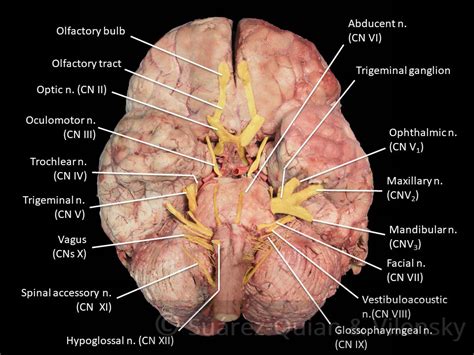 Summary of the Cranial Nerves - TeachMeAnatomy