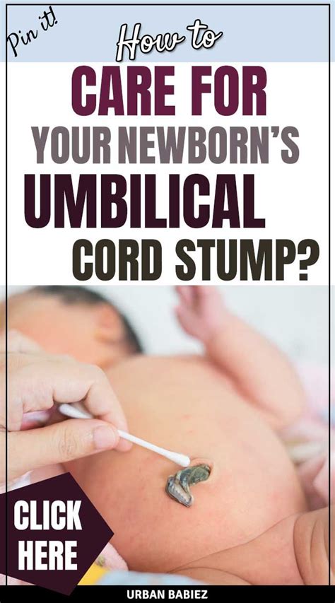 How to Care for Your Newborn’s Umbilical Cord Stump - Urban Babiez | Baby umbilical cord, Baby ...