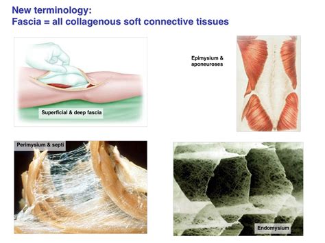 Epimysium Anatomy Definition - Anatomical Charts & Posters