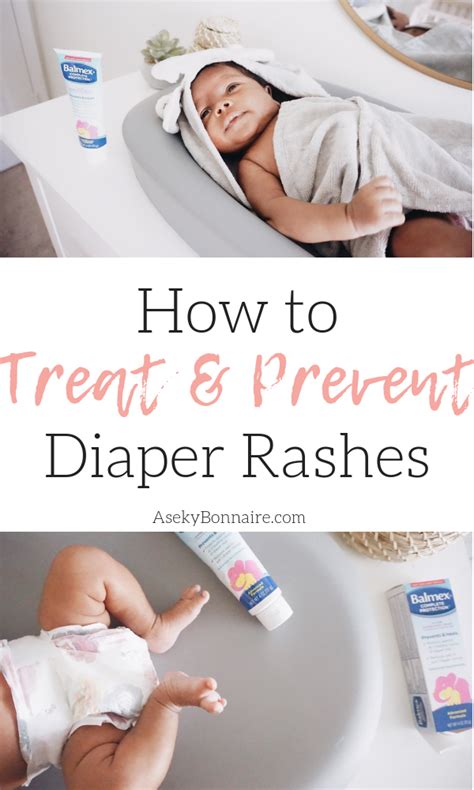 How to Treat and Prevent diaper rashes - Aseky + Co. | Diaper rash, Diaper rash treatment, Baby rash