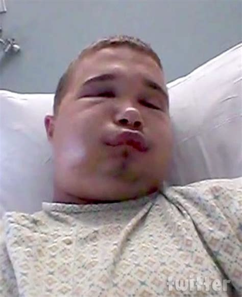 PHOTOS Florida man Austin Hatfield bitten by cottonmouth while kissing it - starcasm.net