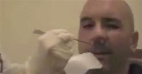 Video Of Doctor Removing 5-Foot Tapeworm From Man's Nose Goes Viral