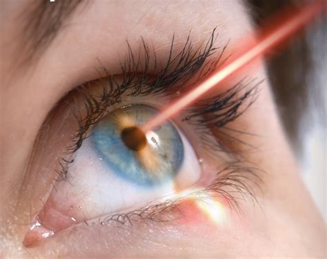 How Long Does Laser Eye Surgery Take - I believe your surgeon should do all the work and ...