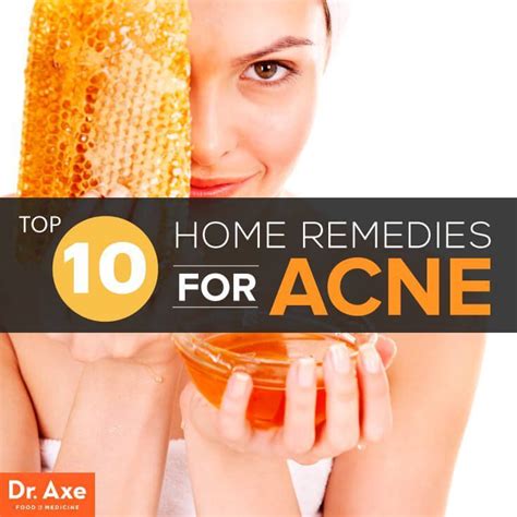 Home Remedies for Acne: 10 Easy Ones That Work - Dr. Axe | Home ...