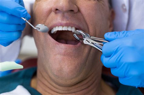 Your first tooth extraction — what to expect - Cornerstone Family Dentistry | Peterborough Dentist