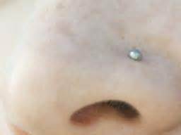 Nose piercing bump: Causes and home remedies