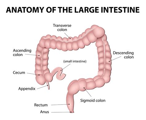 Appendectomy