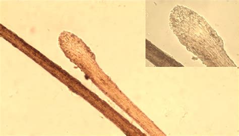 Trichogram: Low‐power (inset) microscopic images of a telogen hair... | Download Scientific Diagram