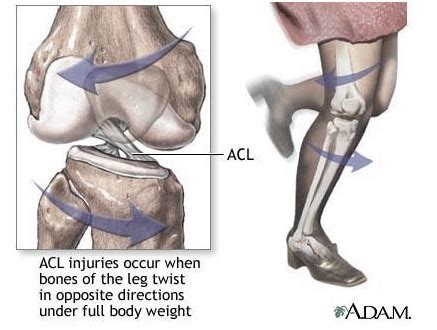 HOW IS A PCL INJURY DIFFERENT FROM AN ACL INJURY? - Get Back To Sport