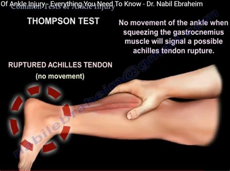 Common Tests Of Ankle Injury — OrthopaedicPrinciples.com