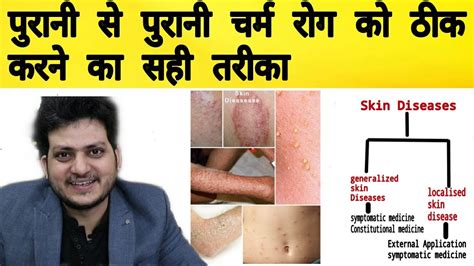 How to Treat Skin Diseases by Homeopathy ? way of treatment | Medicine | Cure | - YouTube