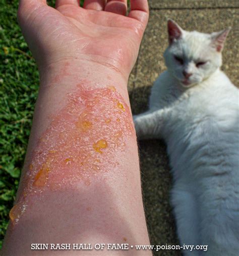 Top 97+ Pictures Pictures Of Rashes From Cats Updated