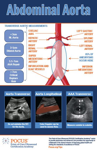 Transverse Aortic Measurements - POCUSWorld