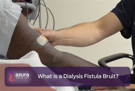 What Is a Dialysis Fistula Bruit? | Azura Vascular Care