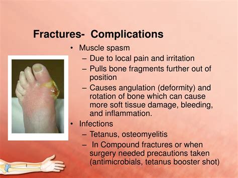 Complications Of Bone Fractures