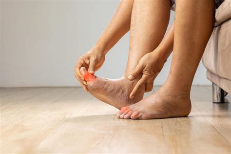 Four Common Causes of Swollen Ankles and How to Treat Them