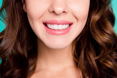 Cosmetic Dentistry - Dental Veneers Alternatives - GDC Smiles Gainesville Georgia