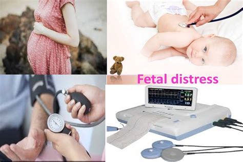 Fetal Distress – Definition, Symptoms, Causes, and More