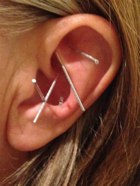 Acudetox Auricular Acupuncture – Solutions for Wellness