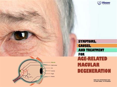 Symptoms and Treatment for Age-Related Macular Degeneration