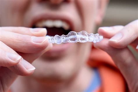 Can Invisalign Fix Crossbite? How Effective Are Clear Aligners?