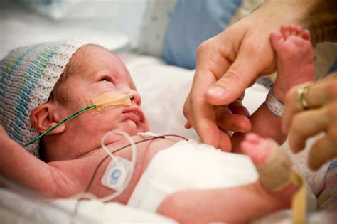 "Life beyond expectations: Baby born 29 weeks premature, weighs 600g ...