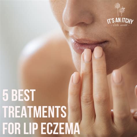 The Best Natural Treatments for Lip Eczema | itchylittleworld.com