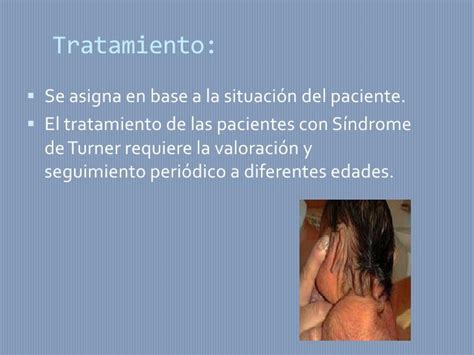 Sindrome de turner, tratamiento