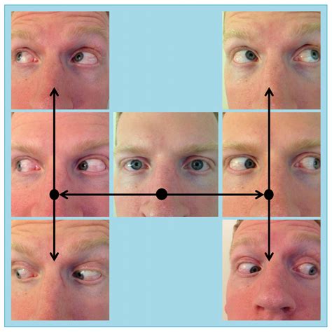 Moran CORE | The Motility Exam