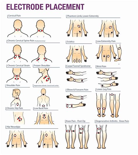 Electrode Pad Placement Chart Elegant Tens Unit Pads Google Search ...