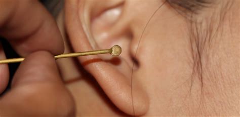 The Best Ear Wax Removal | Reviews, Ratings, Comparisons
