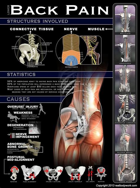 Mejores 42 imágenes de #infografías dolor espalda en Pinterest ...