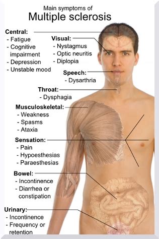 Multiple Sclerosis Symptoms