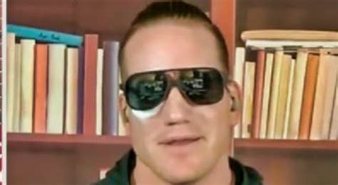 A.J. Hawk Showed off His Eye Injury During The Pat McAfee Show