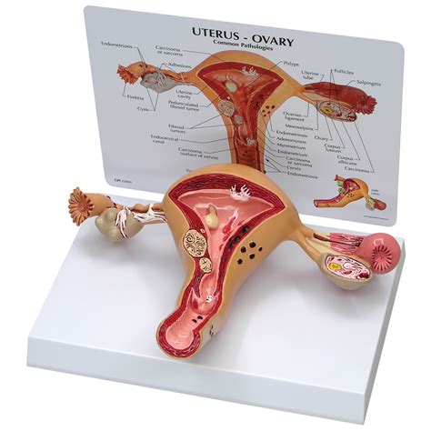 Uterus-Ovary Model | Health Edco | Health Education Models