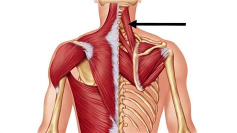 Trapezius And Levator Scapulae