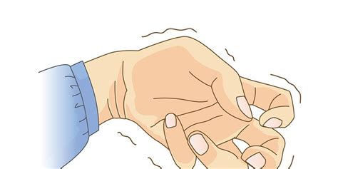 6 Reasons Why Your Hands Are Shaking | Tremors hand, Medical experts, Muscle weakness