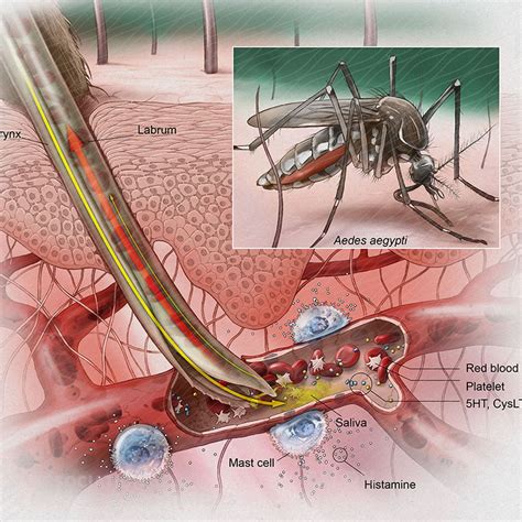 Mosquitos Bites - Prevention - Philadelphia Homeopathic Clinic