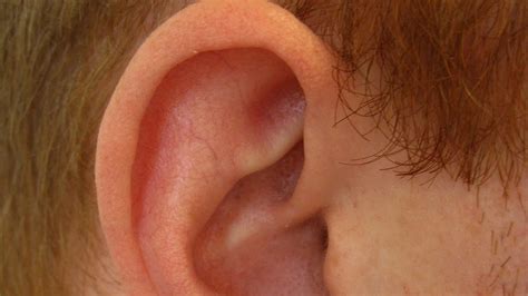 Determine If Ear Cartilage Is Infected | Ear Problems - YouTube