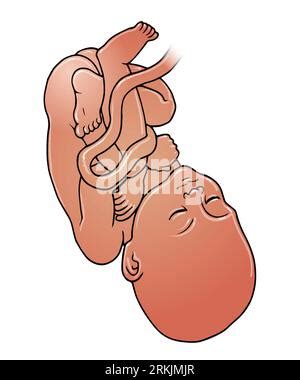 Art of dark skinned baby foetus at between 23-28 weeks, end of 2nd trimester, start of 3rd ...