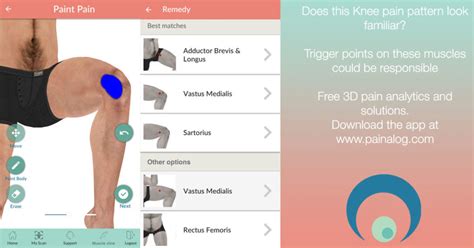 Pain On The Side Of Knee After Running Sale | emergencydentistry.com