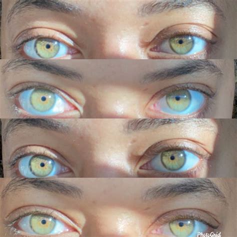 My eyes!💚 | Rare eye colors, Beautiful eyes color, Pretty eyes